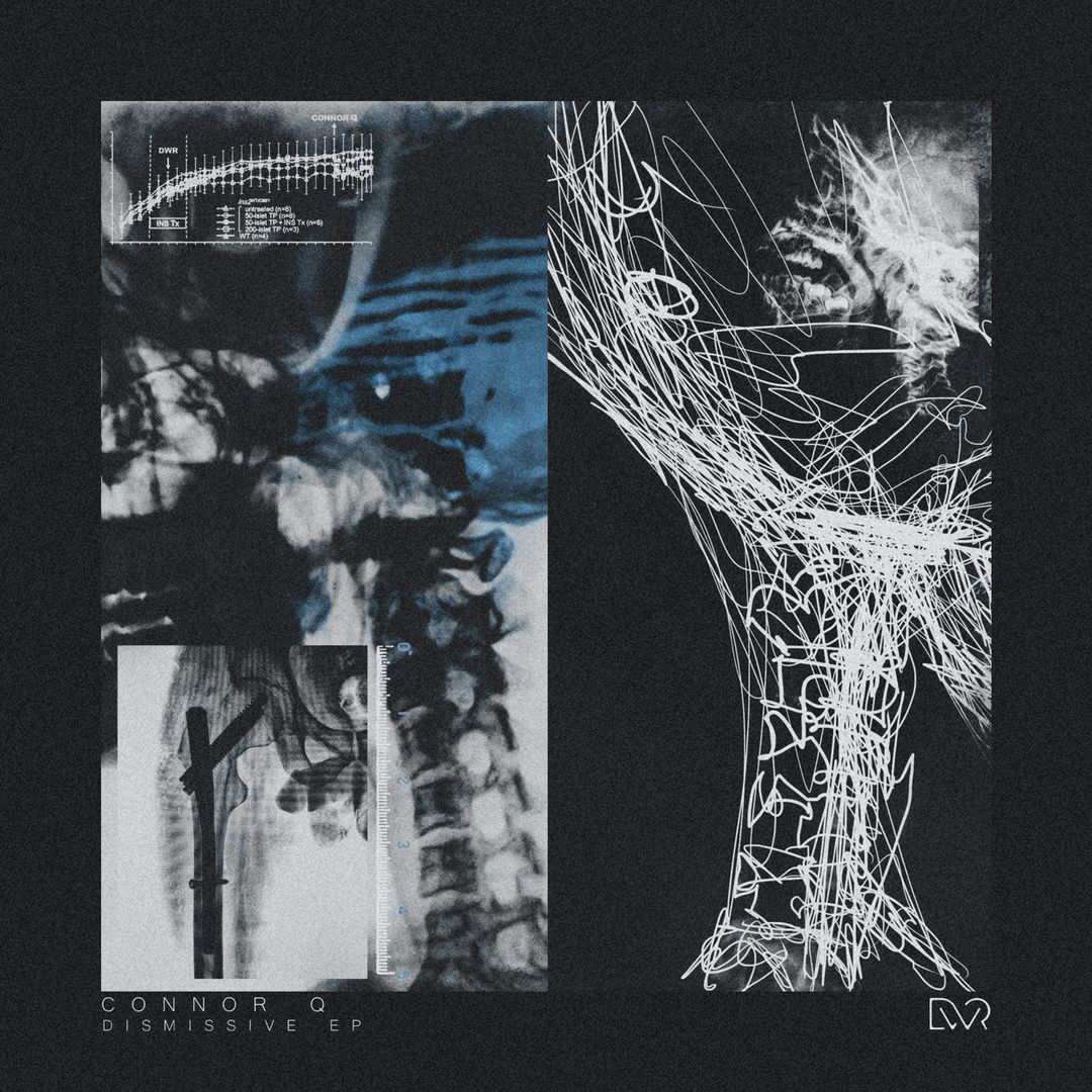 Dismissive EP artwork